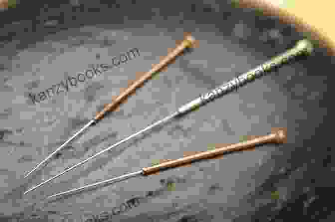 Image Of Acupuncture Needles The Great Intent: Acupuncture Odes Songs And Rhymes